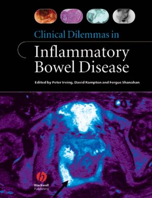 Clinical Dilemmas in Inflammatory Bowel Disease фото №1