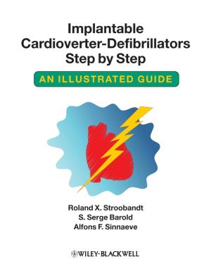 Implantable Cardioverter - Defibrillators Step by Step фото №1